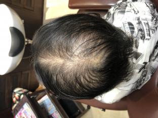 ���ӻܽ�����before��